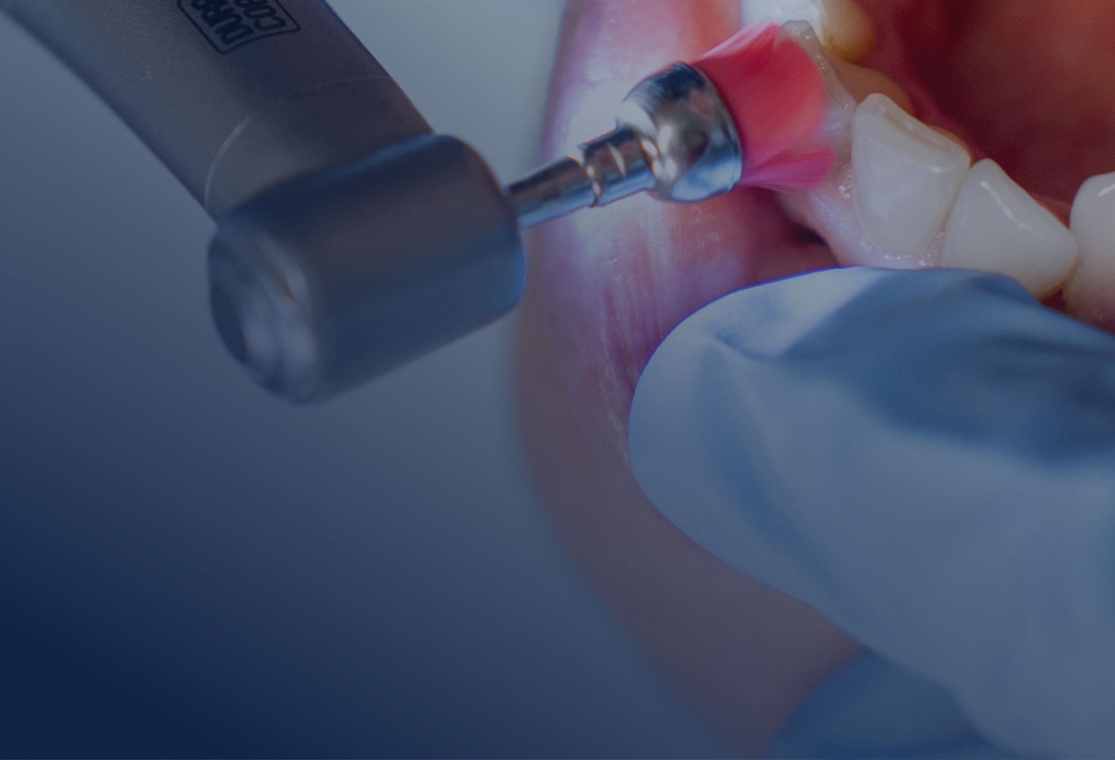 Professionelle Zahnreinigung bei einer Patientin